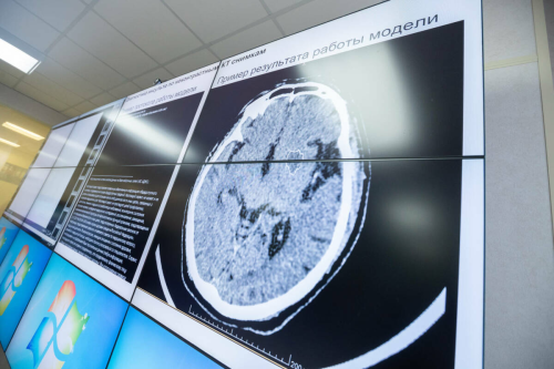 Россиядә баш мие яман шешенә каршы вакцина барлыкка килергә мөмкин